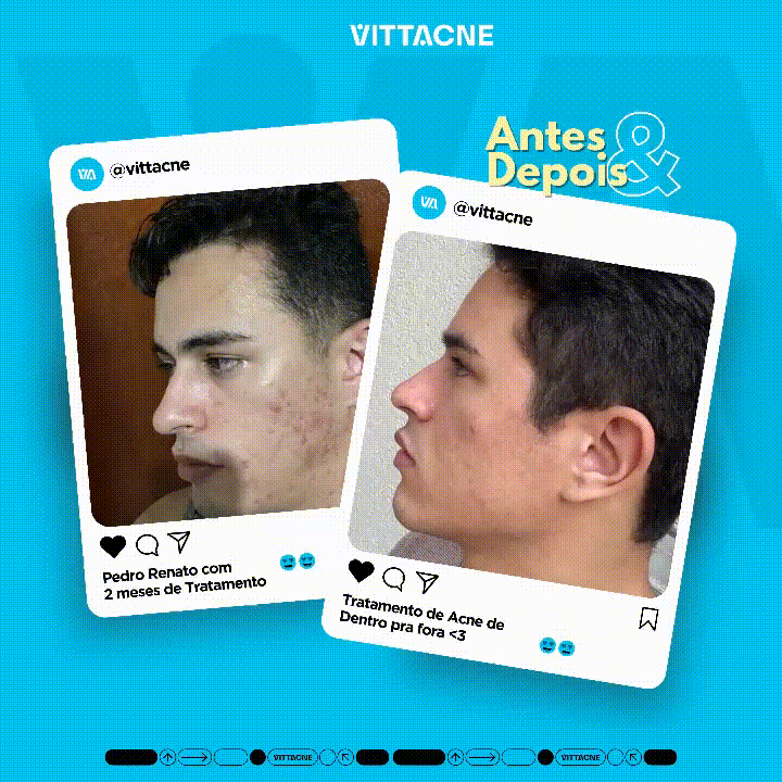 Vittacne - Promoção Compre 2 Leve 3 - 3 Unidades com 60 Cápsulas