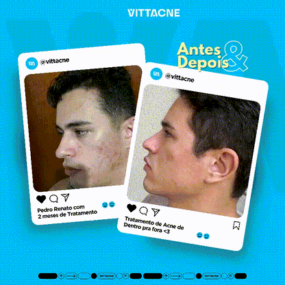 Vittacne - Promoção Compre 2 Leve 3 - 3 Unidades com 60 Cápsulas